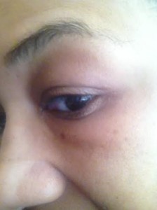 reviva eye serum review eye without makeup