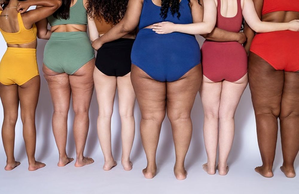 Cellulite is a very common, harmless skin condition that causes lumpy, dimpled flesh on the thighs, hips, buttocks and abdomen.